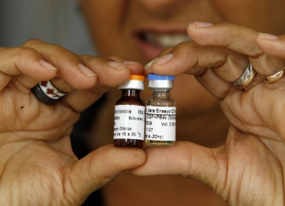 Cuba vừa tìm ra vắc xin phòng bệnh ung thư phổi đầu tiên trên thế giới